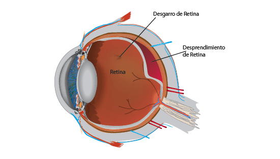 oftalmedic clinica salva retina