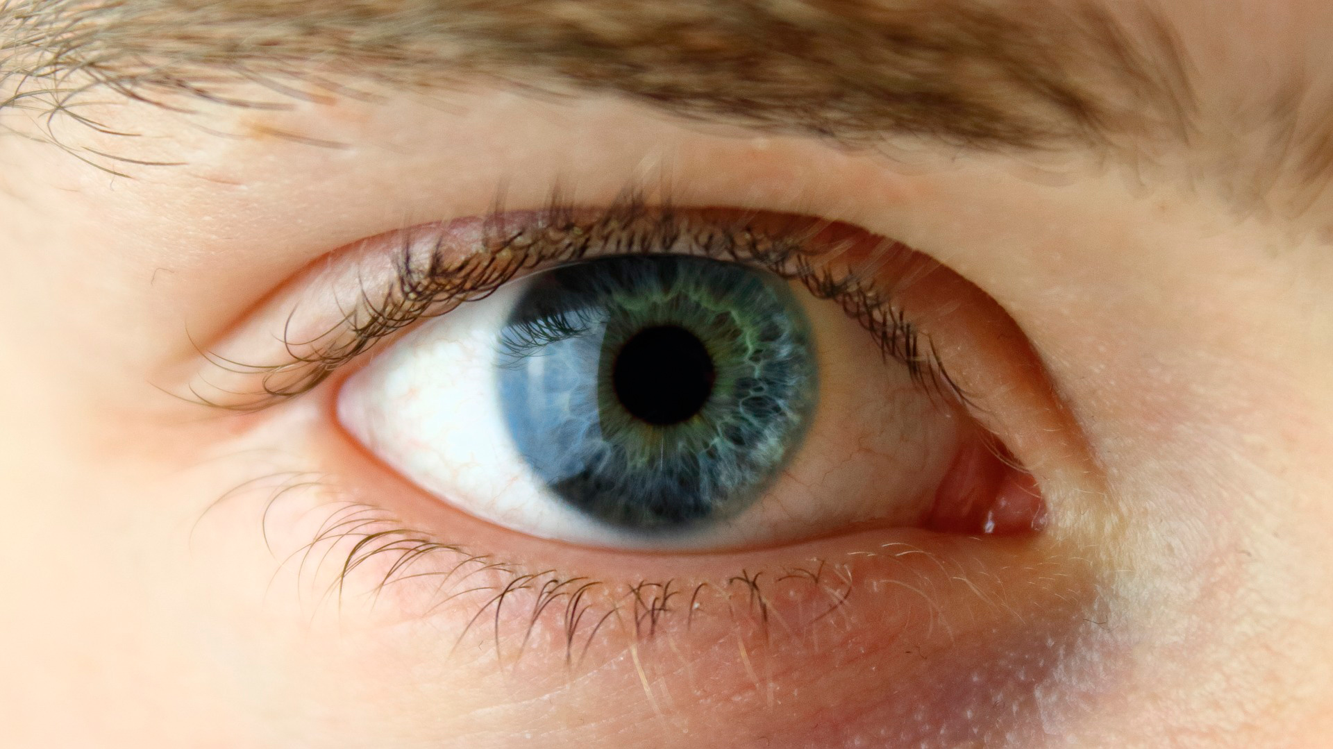 Síntomas unidad de retina Oftalmedic