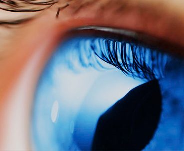 glaucoma-oftalmedic