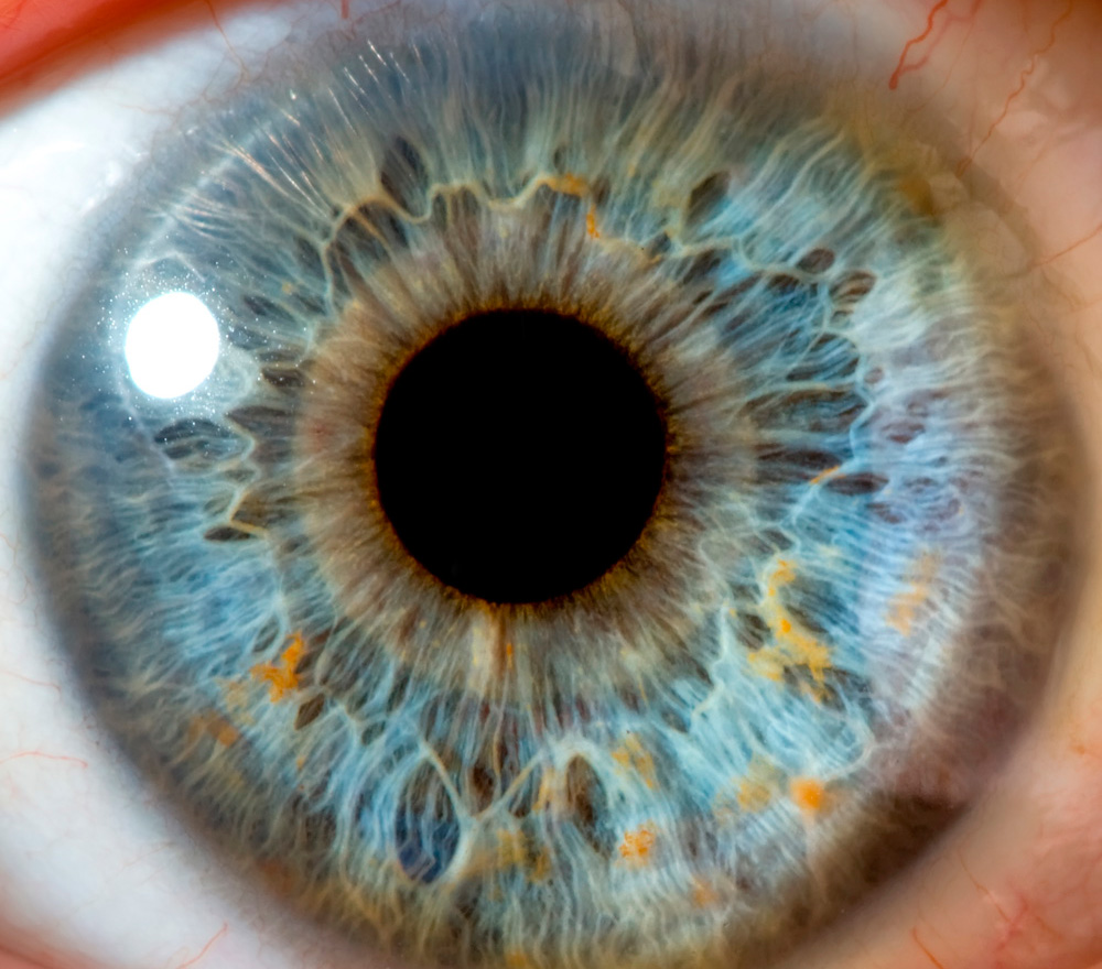 tipos de glaucoma oftalmedic