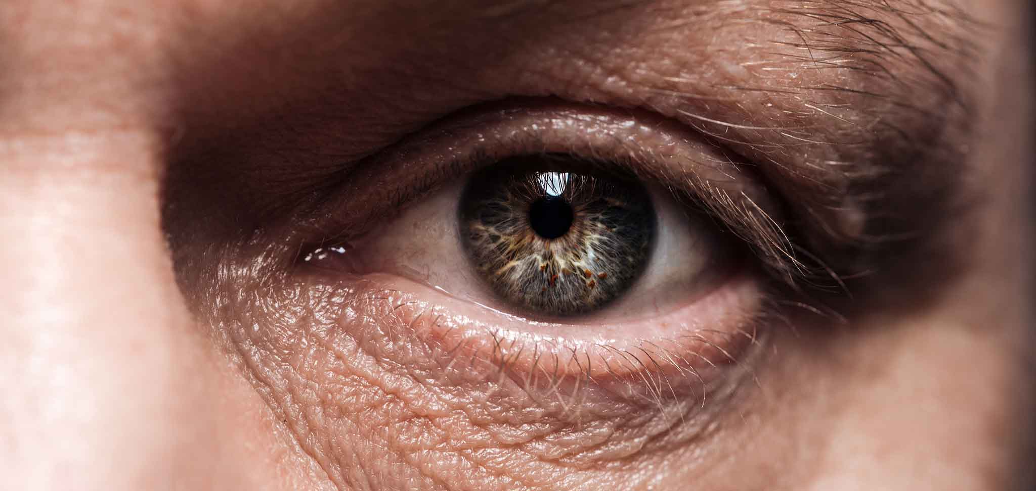 Tratamiento del glaucoma