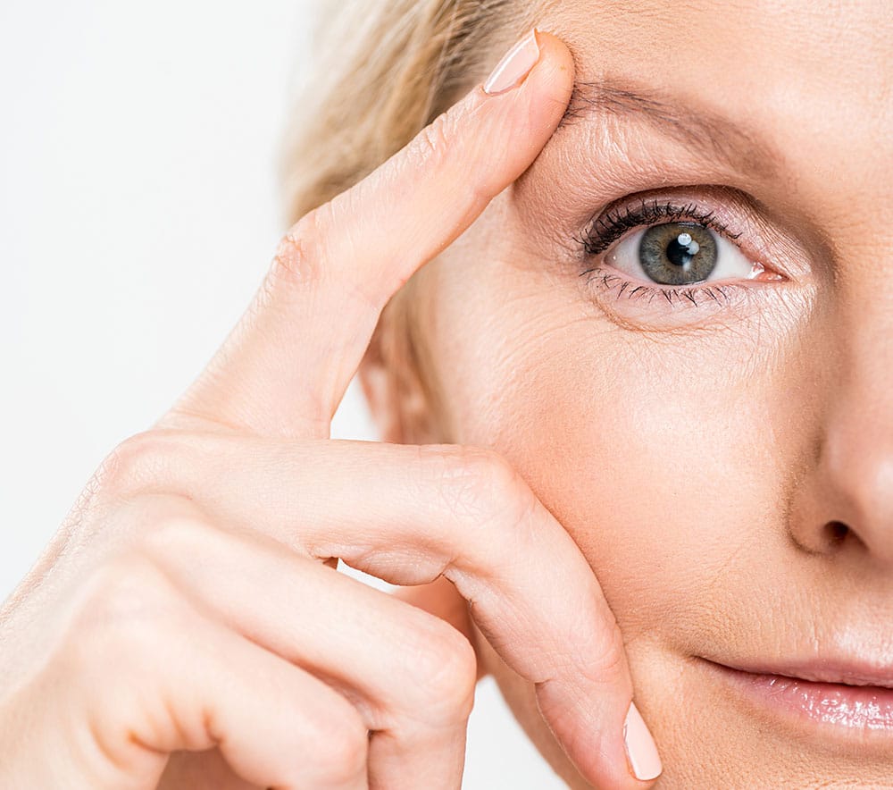 Cejas caídas